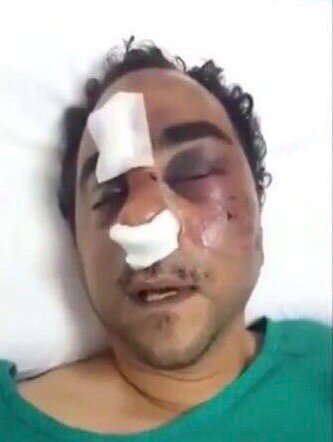 التكفل بعلاج المصري وحيد ...إشاعة