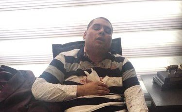 القانوني «المطقوق» في السفارة يروي التفاصيل كاملة: قدمت للسفير كيكة قبل الواقعة بـ 24 ساعة