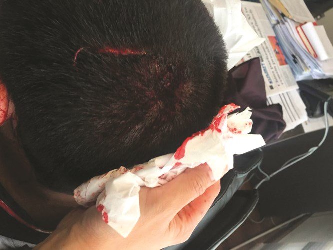 موظفو إحدى السفارات يعتدون على قانوني مصري بآلات حادة