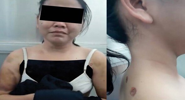 ‏مجدداً.. فلبينية تتعرض للتعذيب من أسرة كفيلها.. والداخلية تفتح تحقيقاً موسعاً في الواقعة