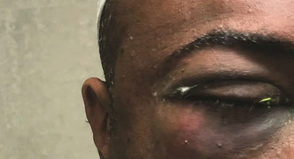 إعتداء على مساعد مدير ثانوية بـ «لكمة» في العين