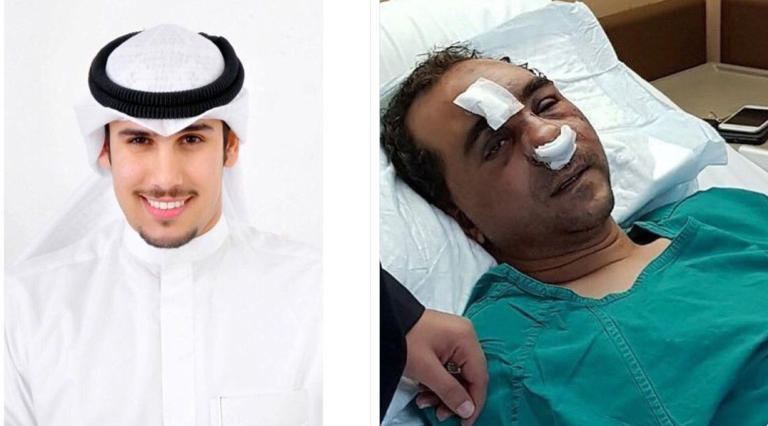 الحبس 17 عاماً للمواطن المعتدي على مصري في «الشويخ الصناعية»